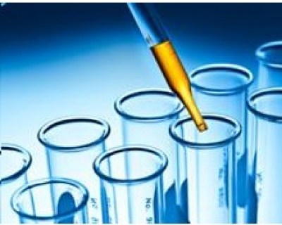 medical-lab-test-results-irvine-ca (Copy)